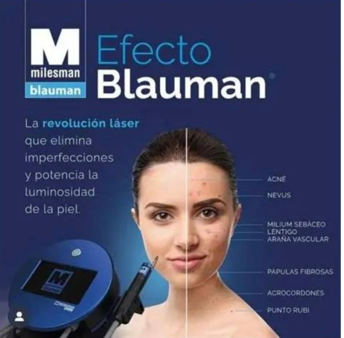 Láser Estético